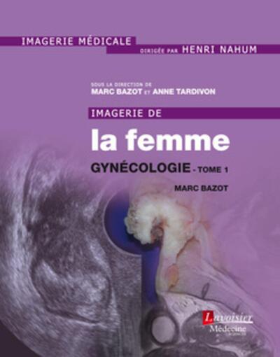 Imagerie de la femme : Gynécologie - Tome 1 (9782257206947-front-cover)