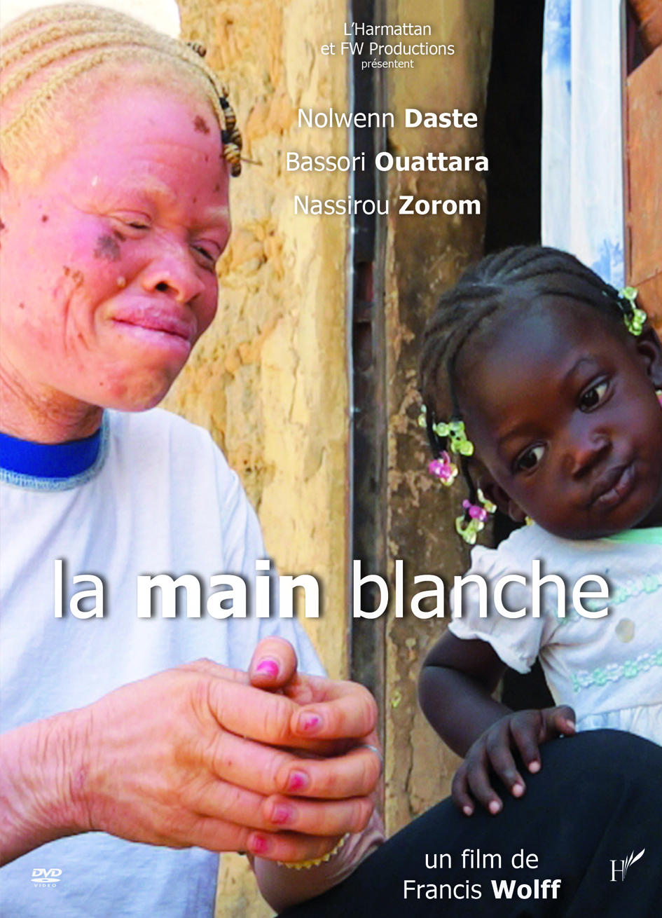 LA MAIN BLANCHE