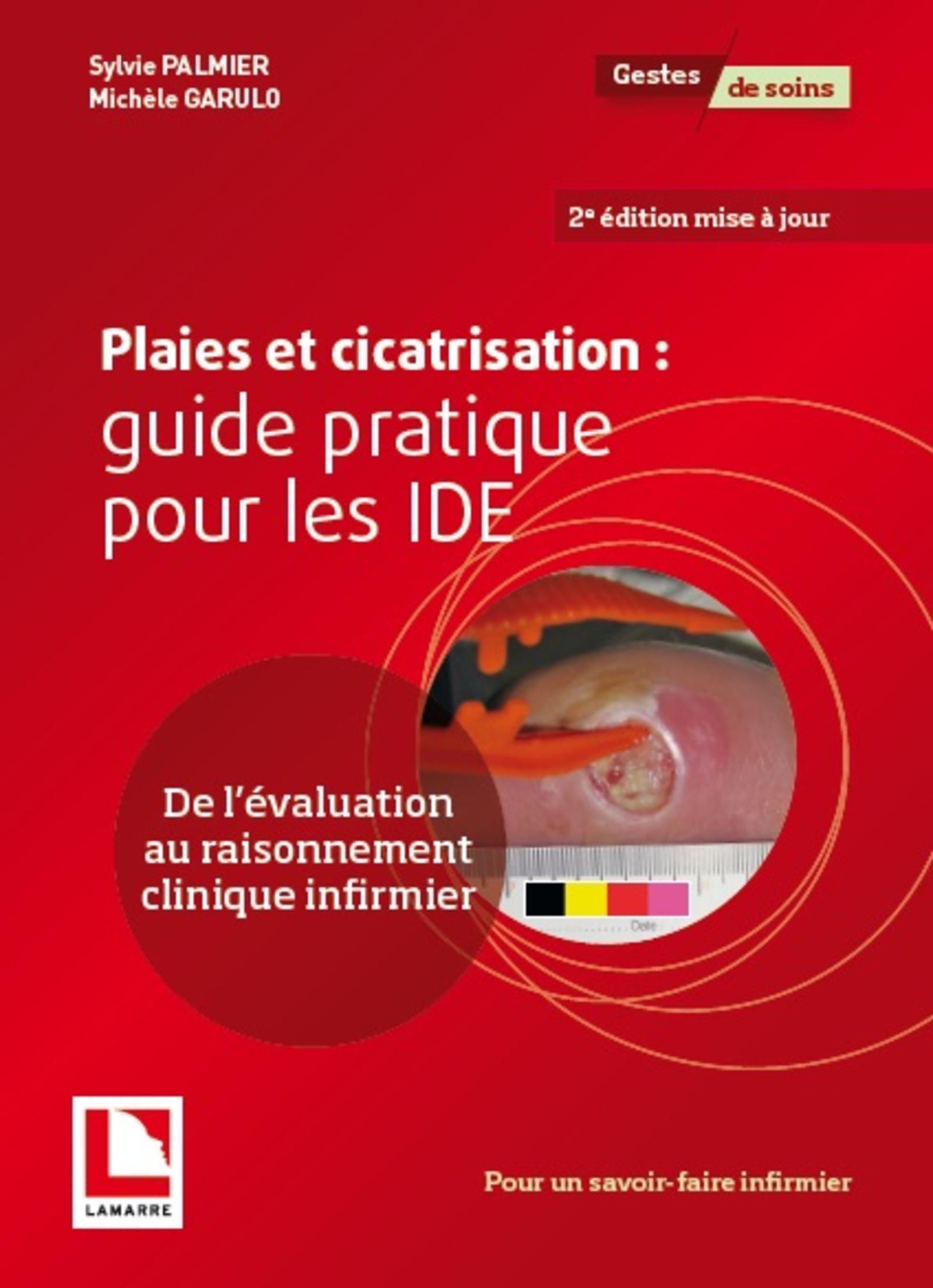 Plaies et cicatrisation: guide pratique pour les IDE