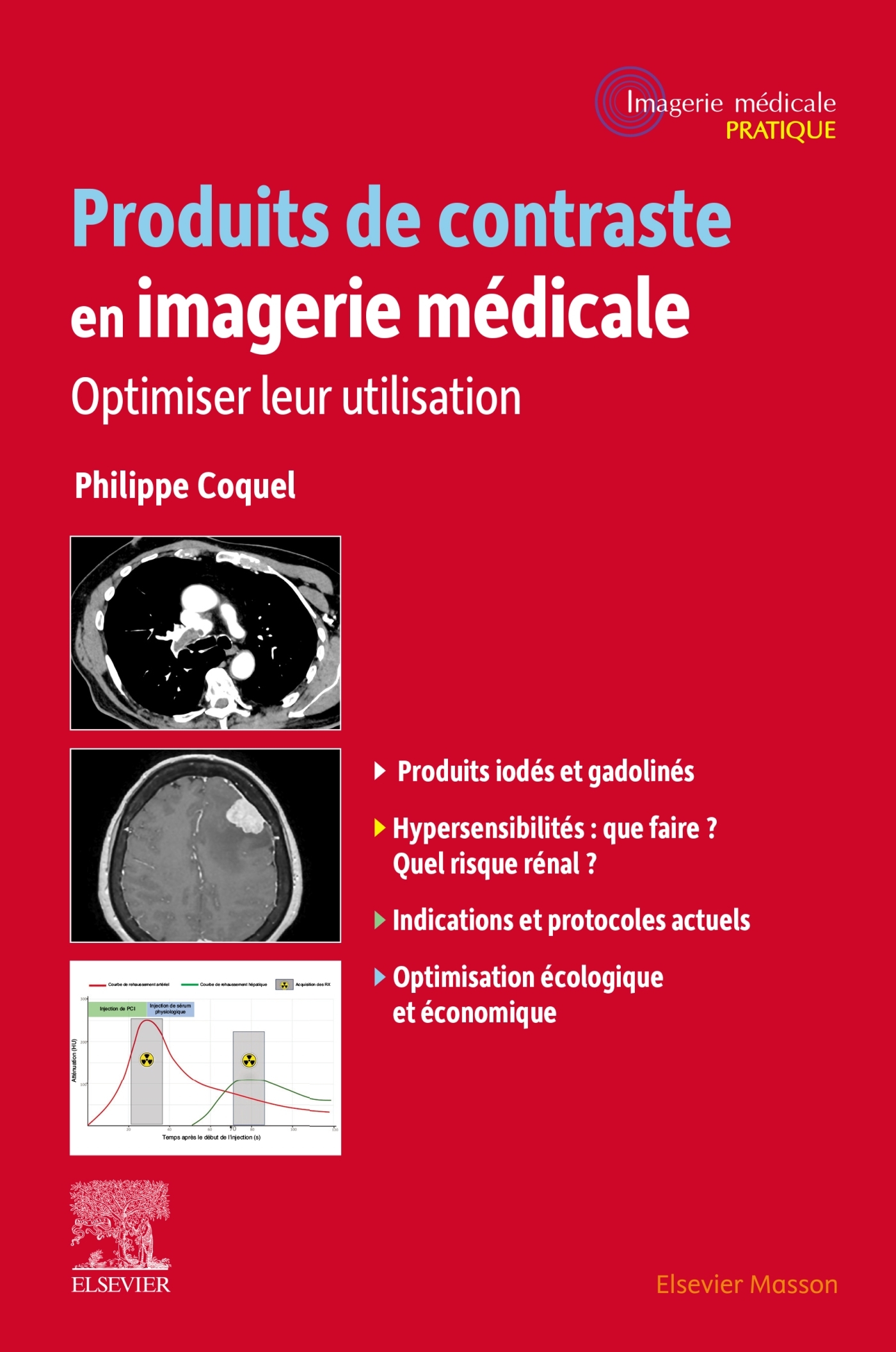 Produits de contraste en imagerie médicale
