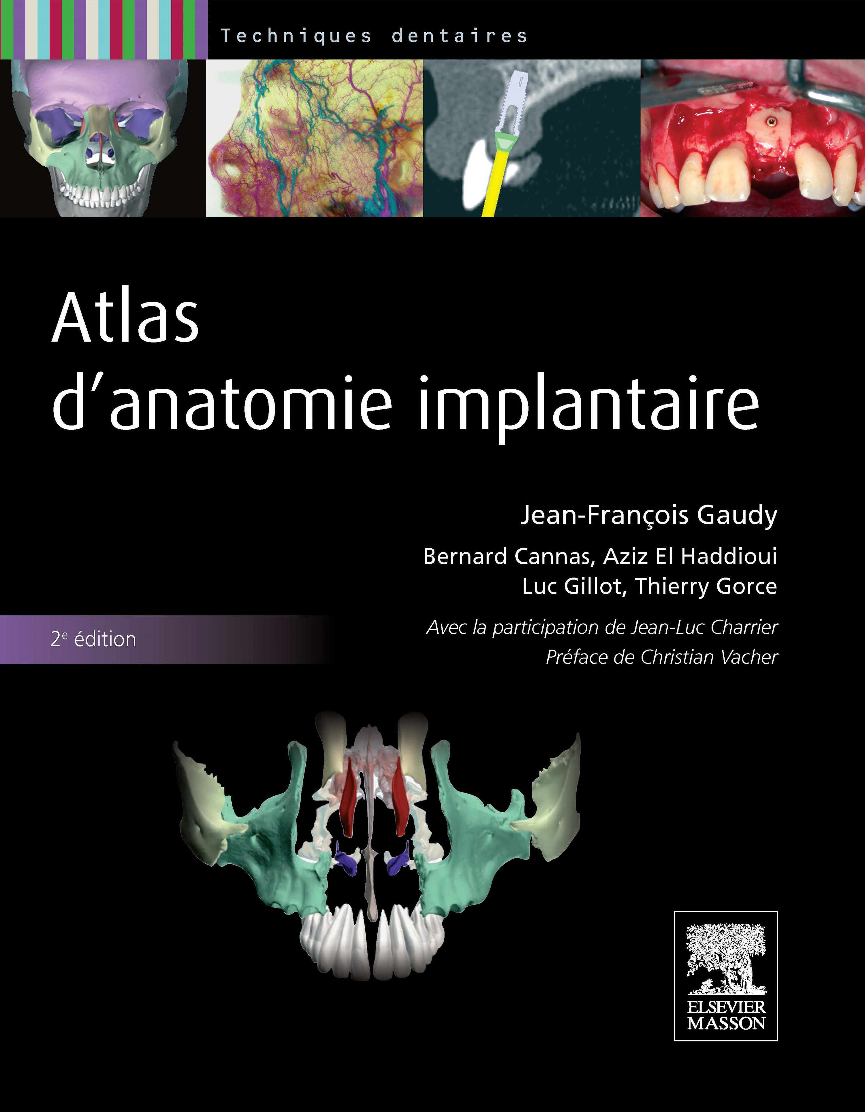 Atlas d'anatomie implantaire