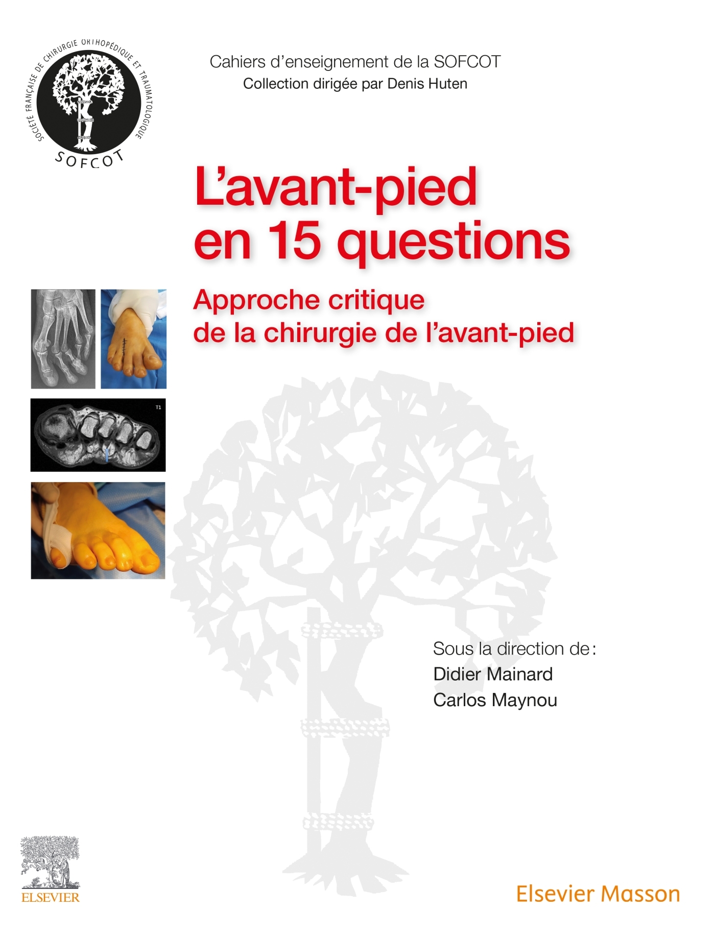 L'avant-pied en 15 questions