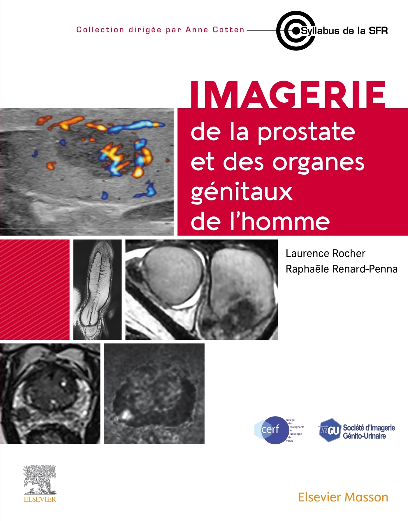 Imagerie de la prostate et des organes génitaux de l'homme