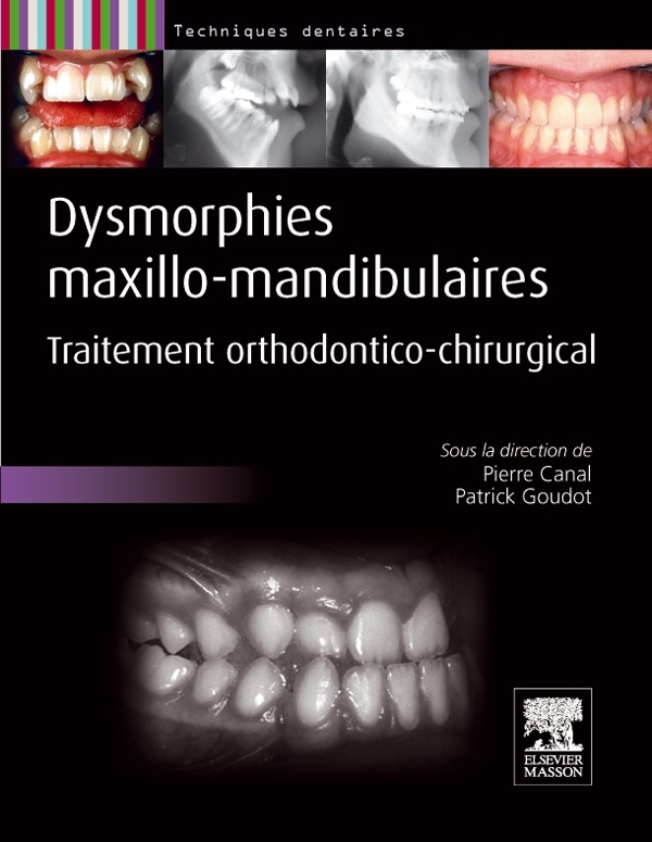 Dysmorphies maxillo-mandibulaires