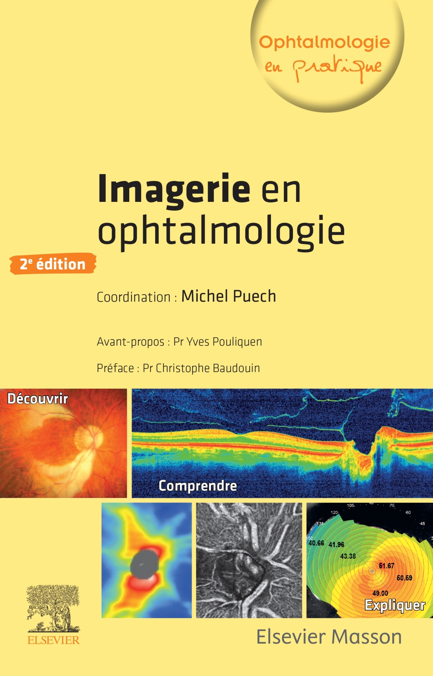 Imagerie en ophtalmologie