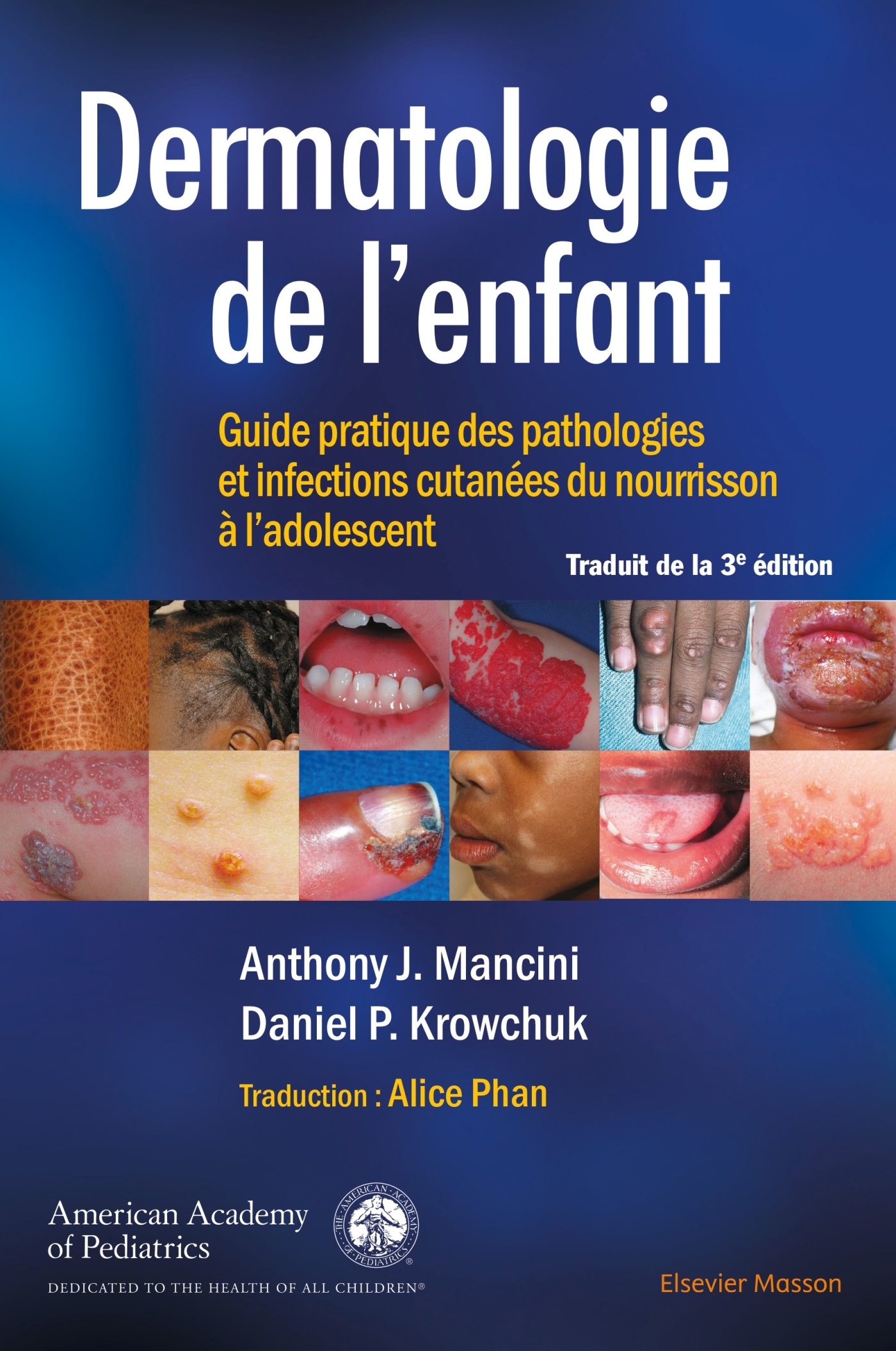 Dermatologie de l'enfant