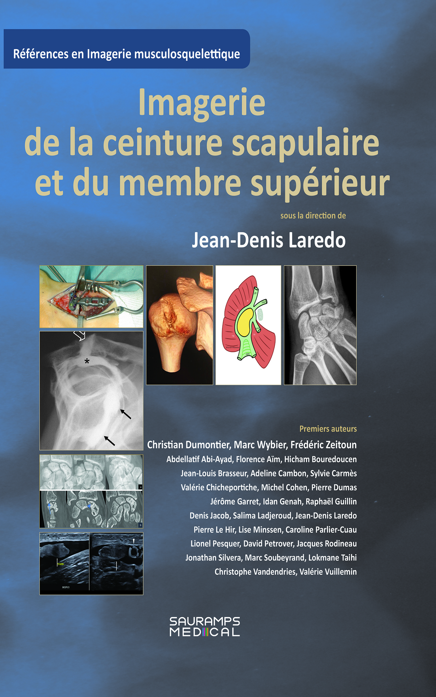 Imagerie de la ceinture scrapulaire et du membre supérieur