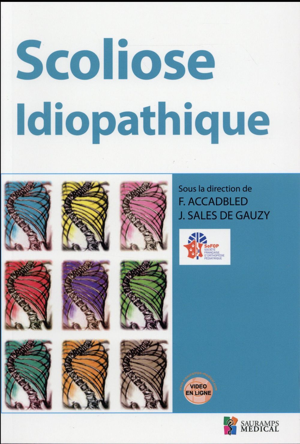 SCOLIOSE IDIOPATHIQUE