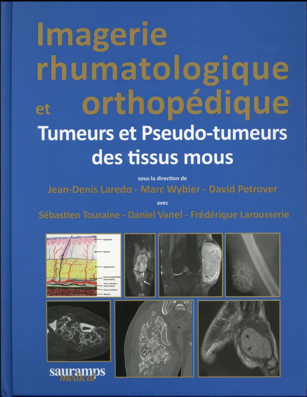 IMAGERIE RHUMATOLOGIQUE ET ORTHOPEDIQUE TOME 5 -TUMEURS ET PSEUDO-TUMEURS DES TI