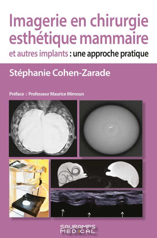 Imagerie en chirurgie esthétique mammaire et autres implants