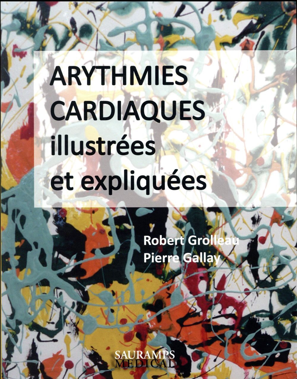 ARYTHMIES CARDIAQUES ILLUSTREES ET EXPLIQUEES