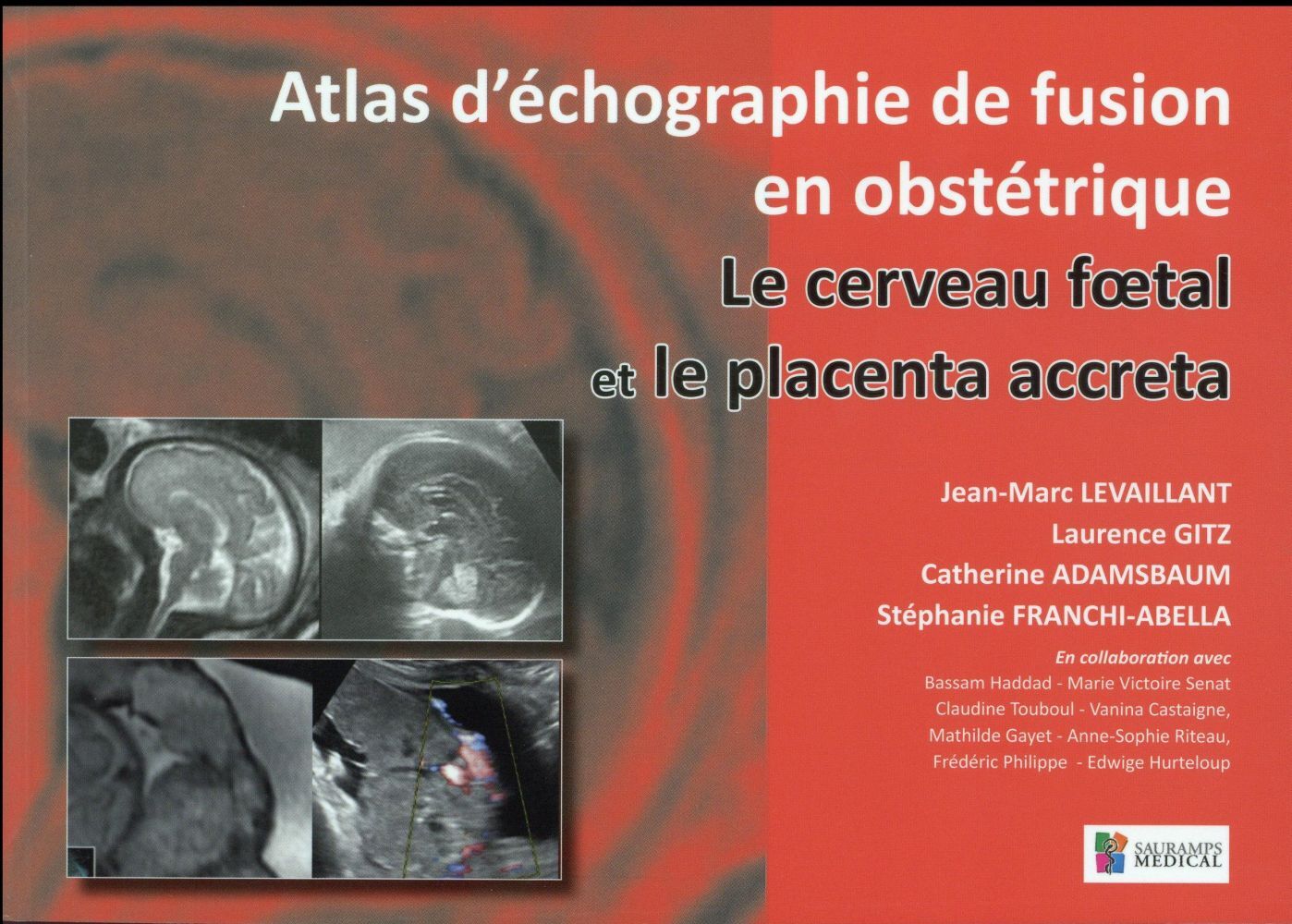 LE CERVEAU FOETAL ET LE PLACENTA ACCRETA. ATLAS D ECHOGRAPHIE DE FUSION EN GYNEC