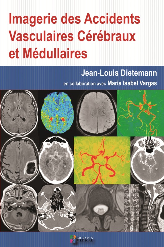 IMAGERIE DES ACCIDENTS VASCULAIRES CEREBRAUX ET MEDULLAIRES