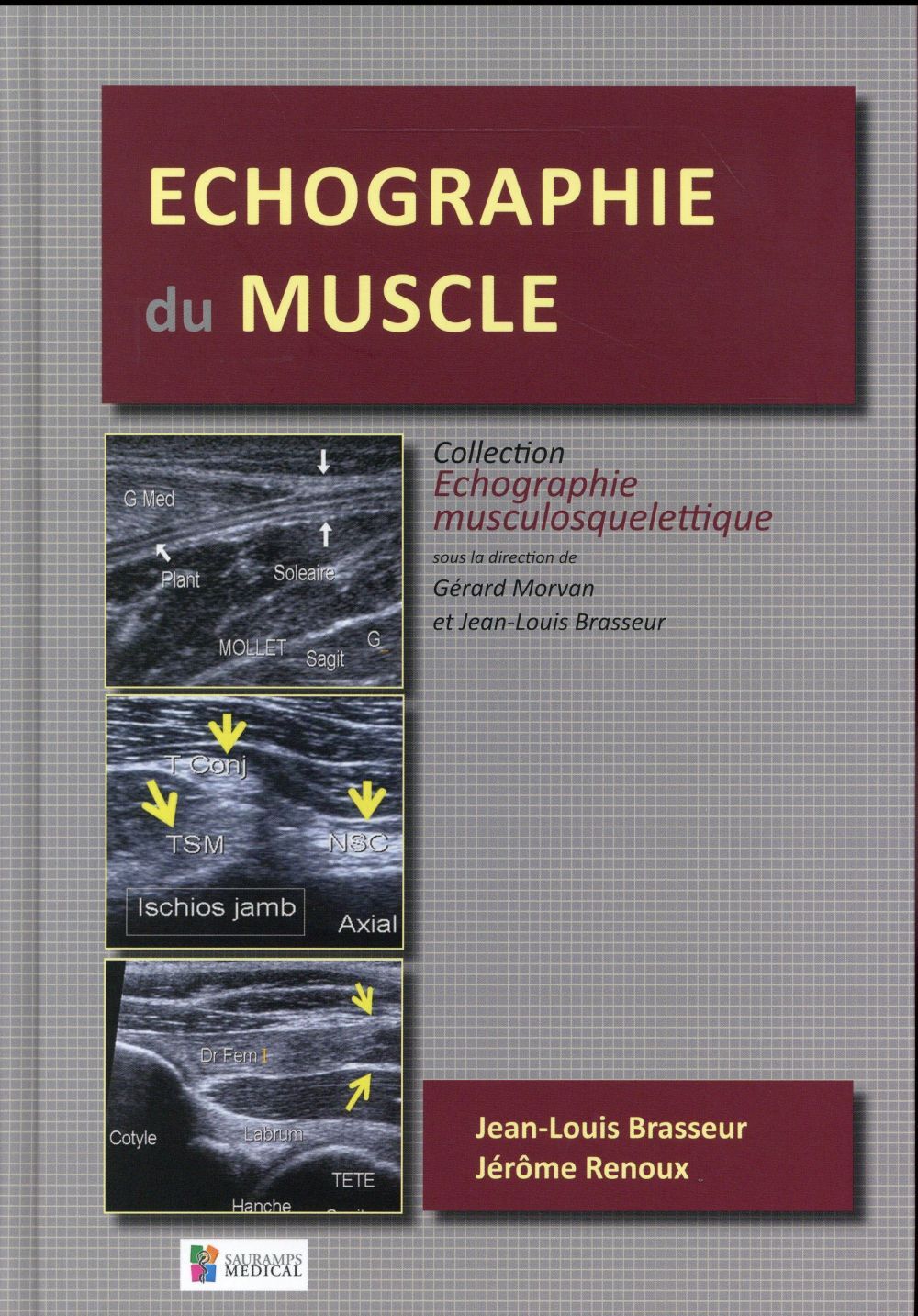 ECHOGRAPHIE DU MUSCLE