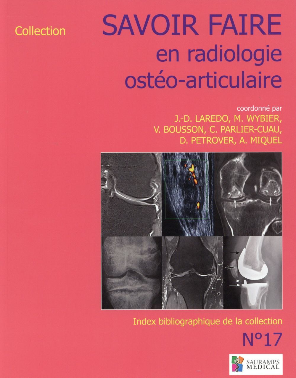 SAVOIR-FAIRE EN RADIOLOGIE OSTEO-ARTICULAIRE N 17