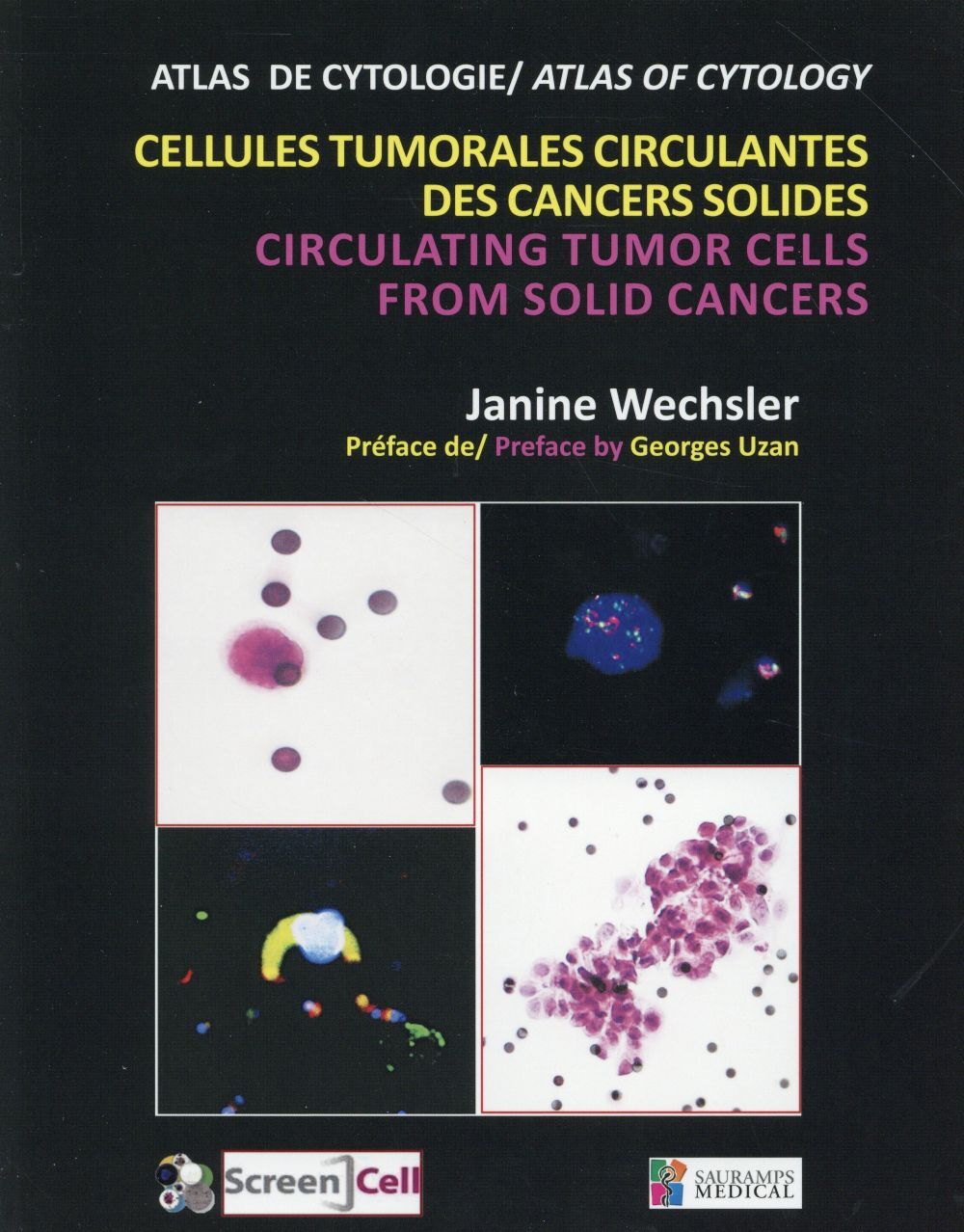 CELLULES TUMORALES CIRCULANTES DES CANCERS SOLIDES - CIRCULATING TUMOR CELLS FRO