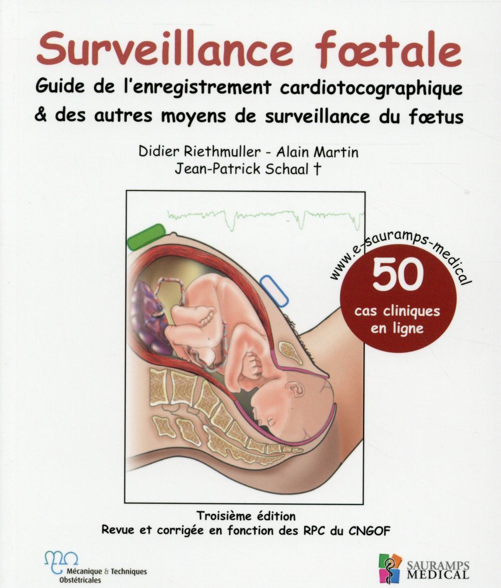SURVEILLANCE FOETALE - GUIDE DE L'ENREGISTREMENT CARDIOTOCOGRAPHIQUE & AUTRES MO