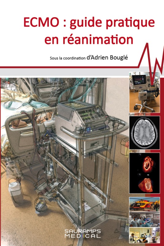 ECMO - GUIDE PRATIQUE DE REANIMATION