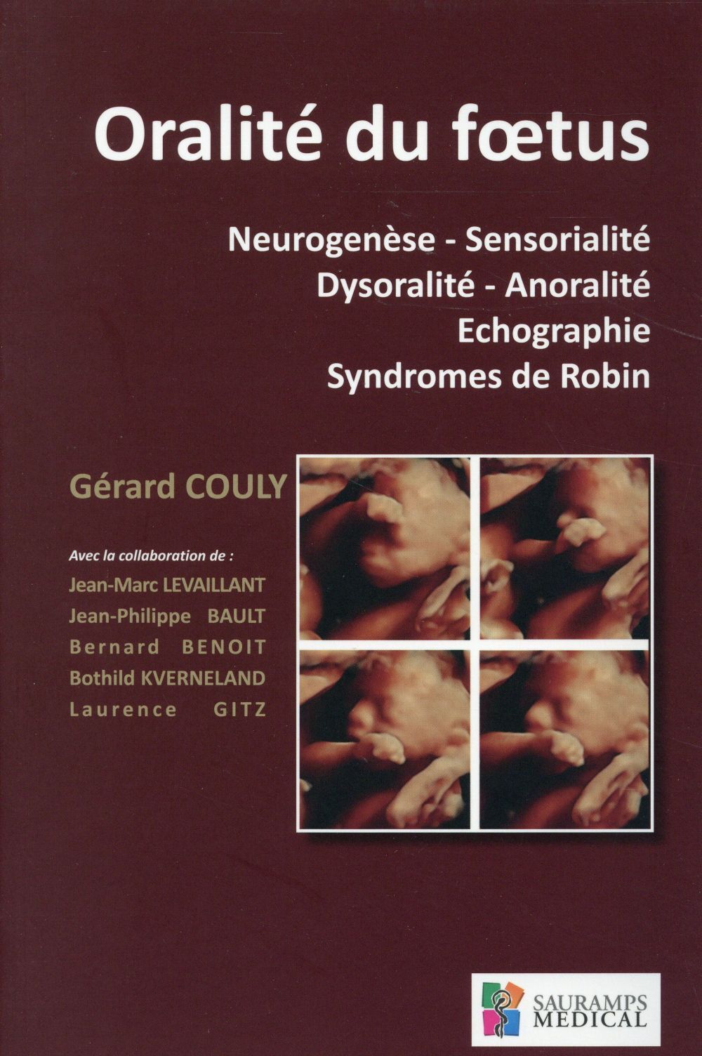 ORALITE DU FOETUS. NEUROGENESE.SENSORIALITE.DYSORALITE.ANORALITE.ECHOGRAPHIE.SYN