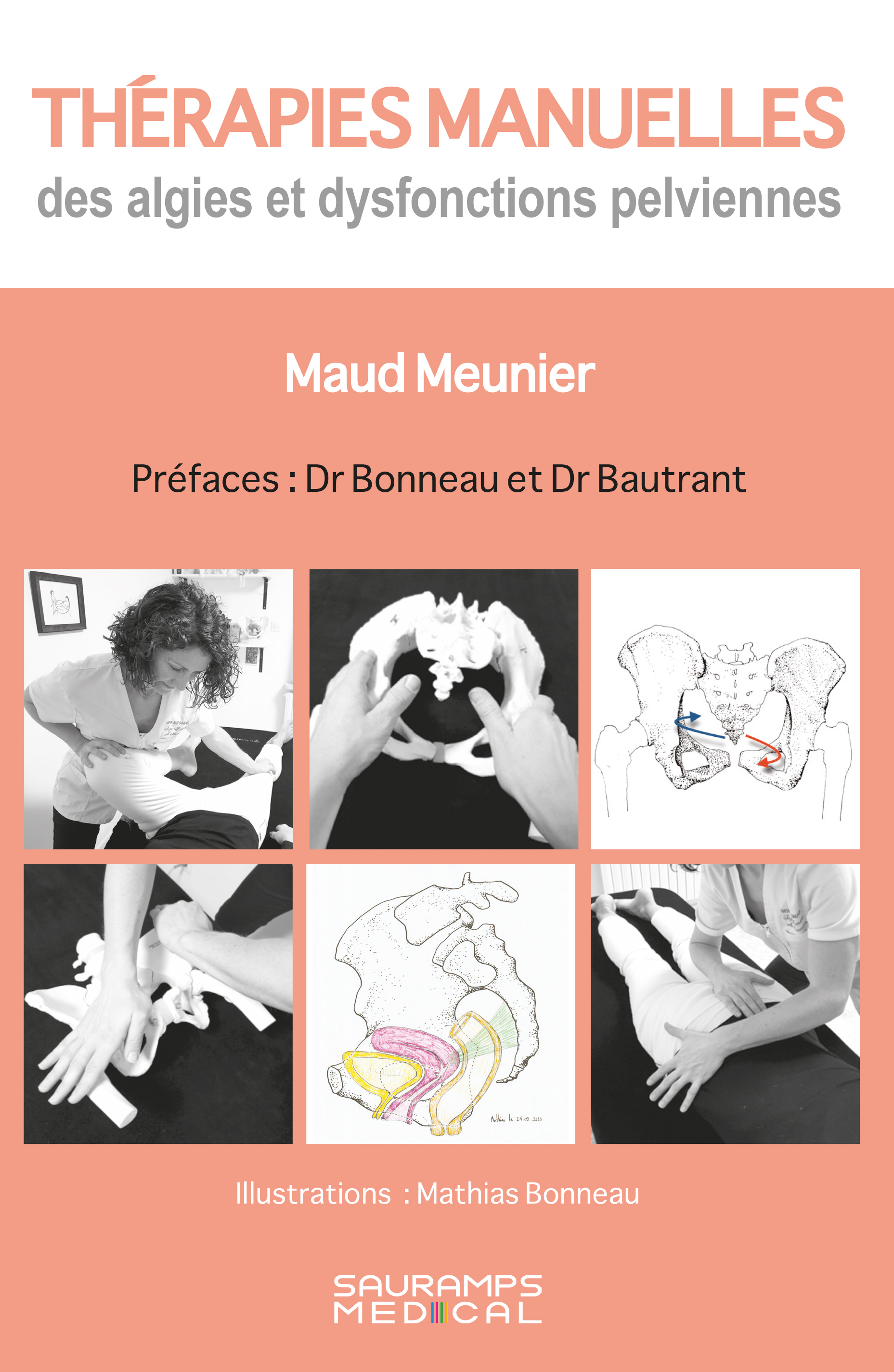 Thérapies manuelles des algies et dysfonctions pelviennes
