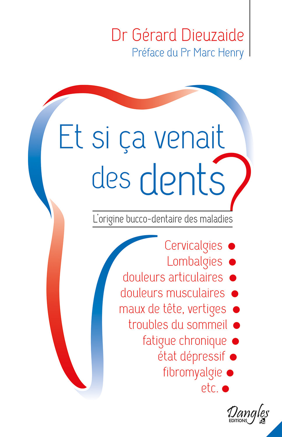 Et si ça venait des dents ? L'origine bucco-dentaire des maladies