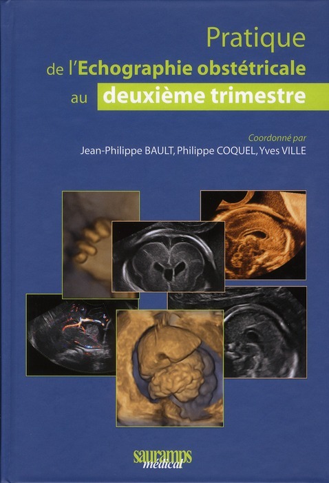 PRATIQUE DE L ECHOGRAPHIE OBSTETRICALE AU 2E TIMESTRE 2E ED