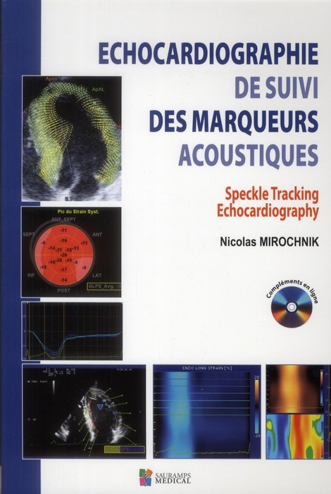 ECHOCARDIOGRAPHIE DE SUIVI DES MARQUEURS ACOUSTIQUE. SPECKLE TRACKING ECHOCARDIO