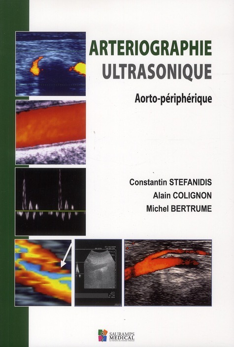 ARTERIOGRAPHIE ULTRASONIQUE