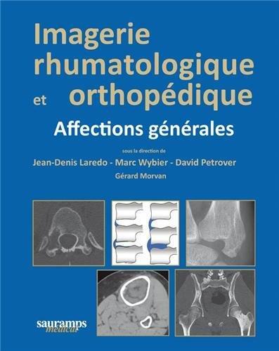 IMAGERIE RHUMATOLOGIQUE ET ORTHOPEDIQUE TOME 1- AFFECTIONS GENERALES