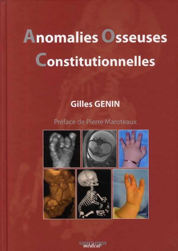 ANOMALIES OSSEUSES CONSTIUTIONNELLES