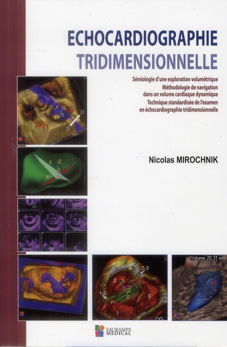 ECHOCARDIOGRAPHIE TRIDIMENSIONNELLE