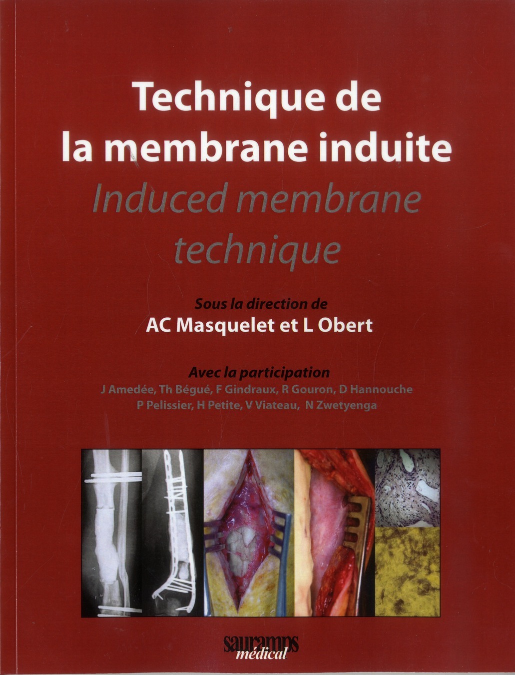 TECHNIQUE DE LA MEMBRANE INDUITE - INDUCED MEMBRANE TECHNIQUE