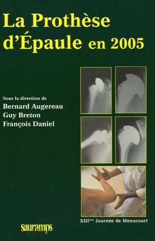 LA PROTHESE D EPAULE EN 2005