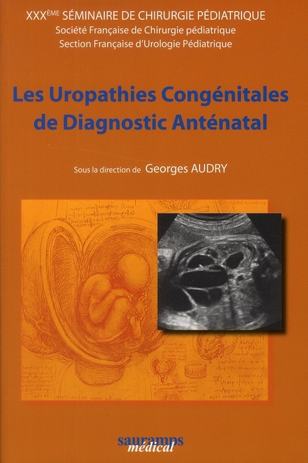 LES UROPATHIES CONGENITALES DE DIAGNOSTIC PRENATAL