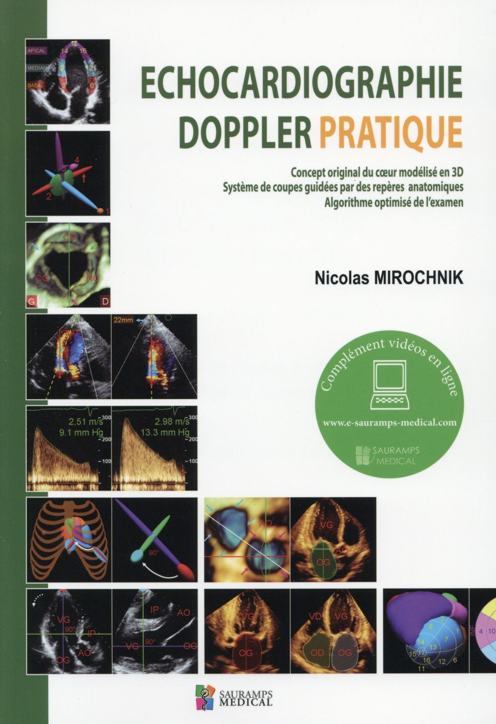 ECHOCARDIOGRAPHIE DOPPLER PRATIQUE