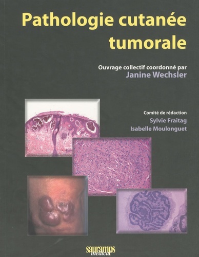 PATHOLOGIE CUTANEE TUMORALE