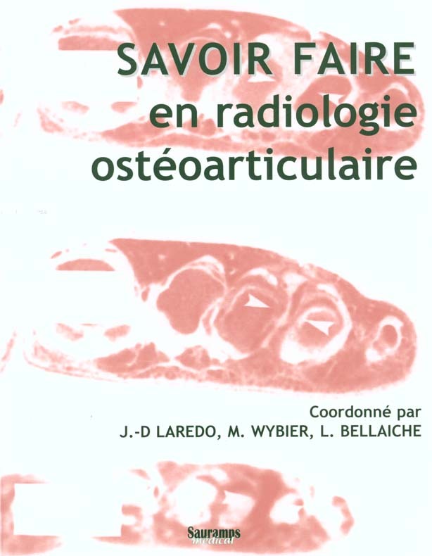 SAVOIR FAIRE EN RADIO OSTEO-RADICULAIRE
