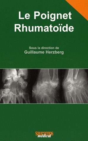 LE POIGNET RHUMATOIDE