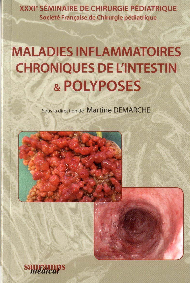 MALADIES INFLAMMATOIRES CHRONIQUES DE L'INTESTIN & POLYPOSES