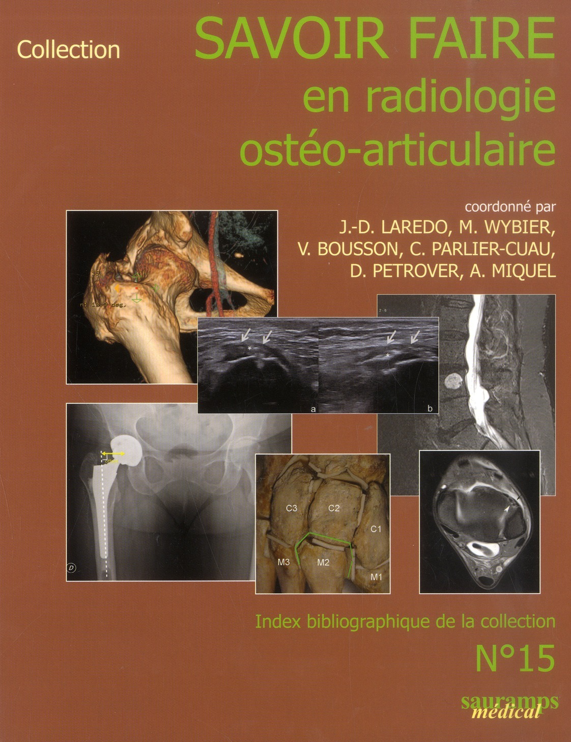 SAVOIR-FAIRE EN RADIOLOGIE OSTEO-ARTICULAIRE N 15
