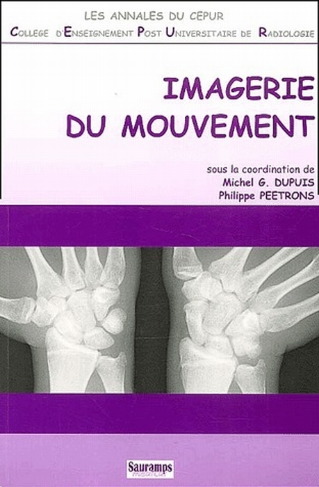IMAGERIE DU MOUVEMENT