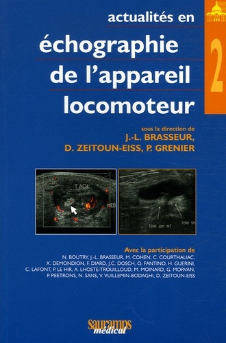 ACTUALITES EN ECHOGRAPHIE DE L APPAREIL LOCOMOTEUR T2