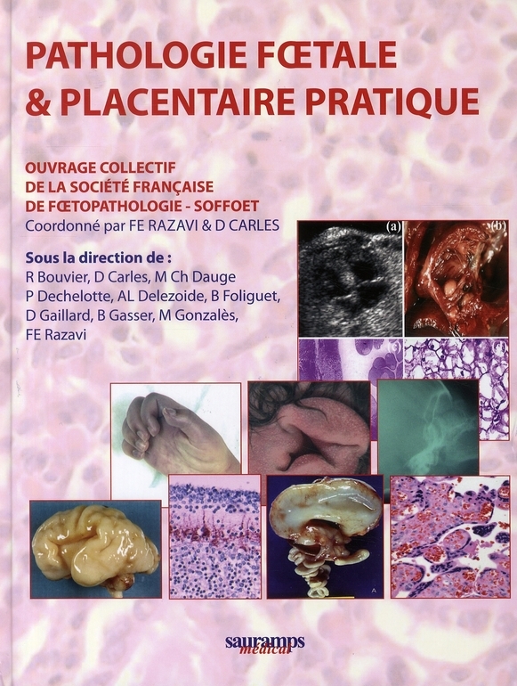 PATHOLOGIE FOETALE ET PLACENTAIRE PRATIQUE