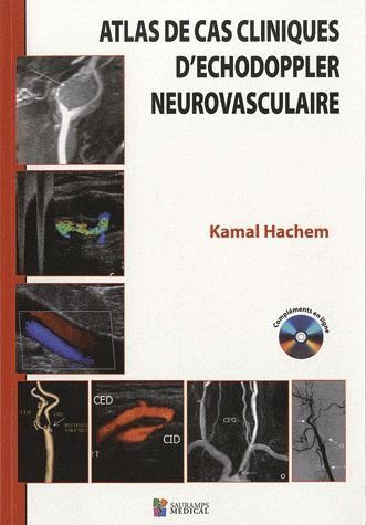 ATLAS DES CAS CLINIQUES D'ECHODOPPLER NEUROVASCULAIRE
