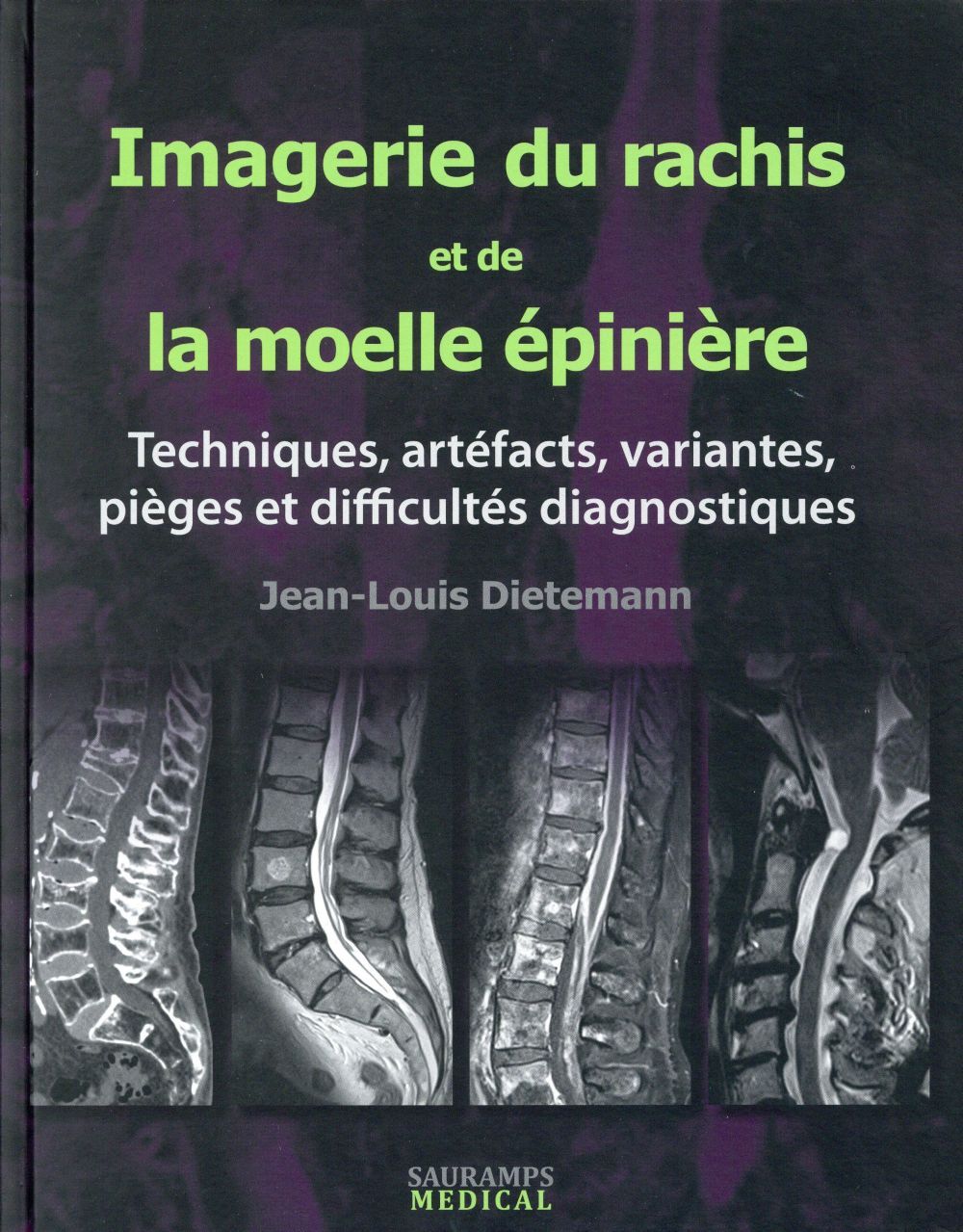 IMAGERIE DU RACHIS ET DE LA MOELLE EPINIERE
