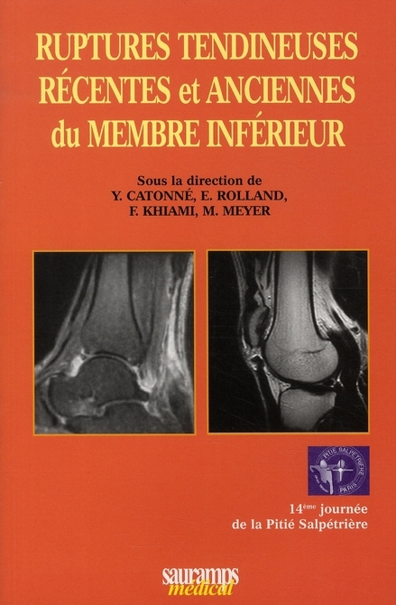 RUPTURES TENDINEUSES RECENTES ET ANCIENNES DU MEMBRE SUPERIEUR