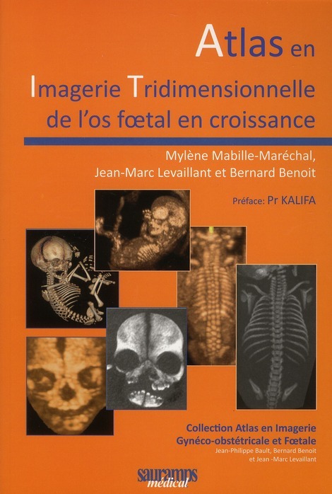 ATLAS EN IMAGERIE TRIDIMENSIONNEELLE DE L OS FOETAL EN CROISSANCE
