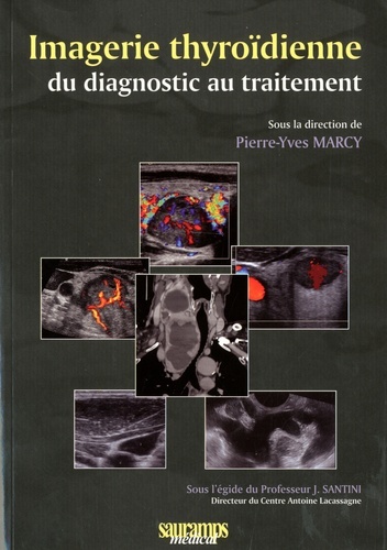 Imagerie thyroïdienne du diagnostic au traitement