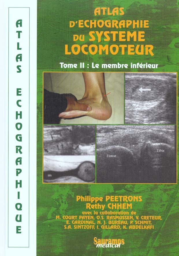ATLAS D'ECHOGRAPHIQUE DU SYSTEME LOCOMOTEUR - TOME II - MEMBRE INFERIEUR