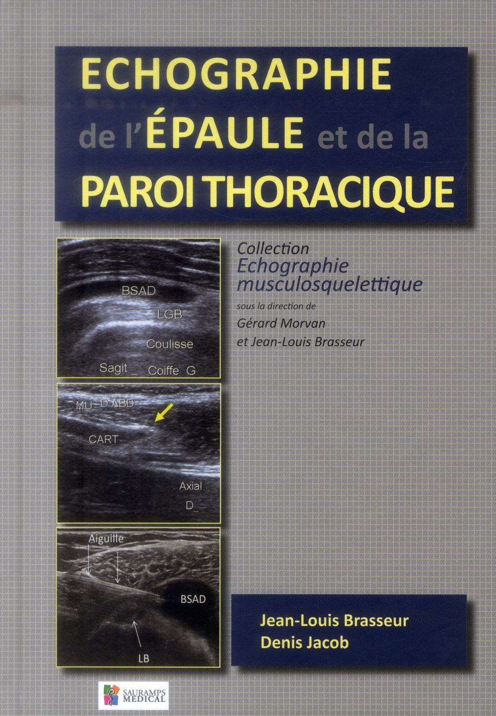 ECHOGRAPHIE DE L'EPAULE ET DE LA PAROI THORACIQUE
